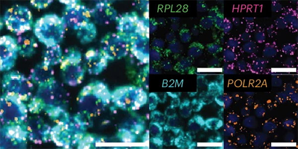 Fluorescent microscopy images of four single-colour panels using PASTA to highlight one gene each, layered into a composite, multicoloured image in a fifth panel.