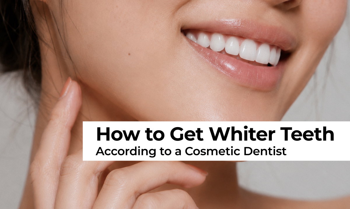 How to Actually Whiten Your Teeth, Without Wrecking Your Enamel