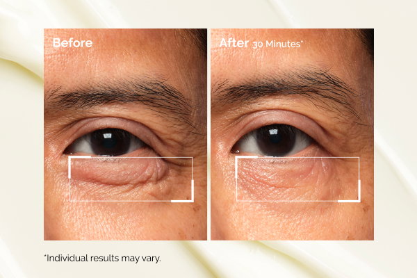 Learn more about our Lacto-PDRN* 4% + B9 Eye Cream.