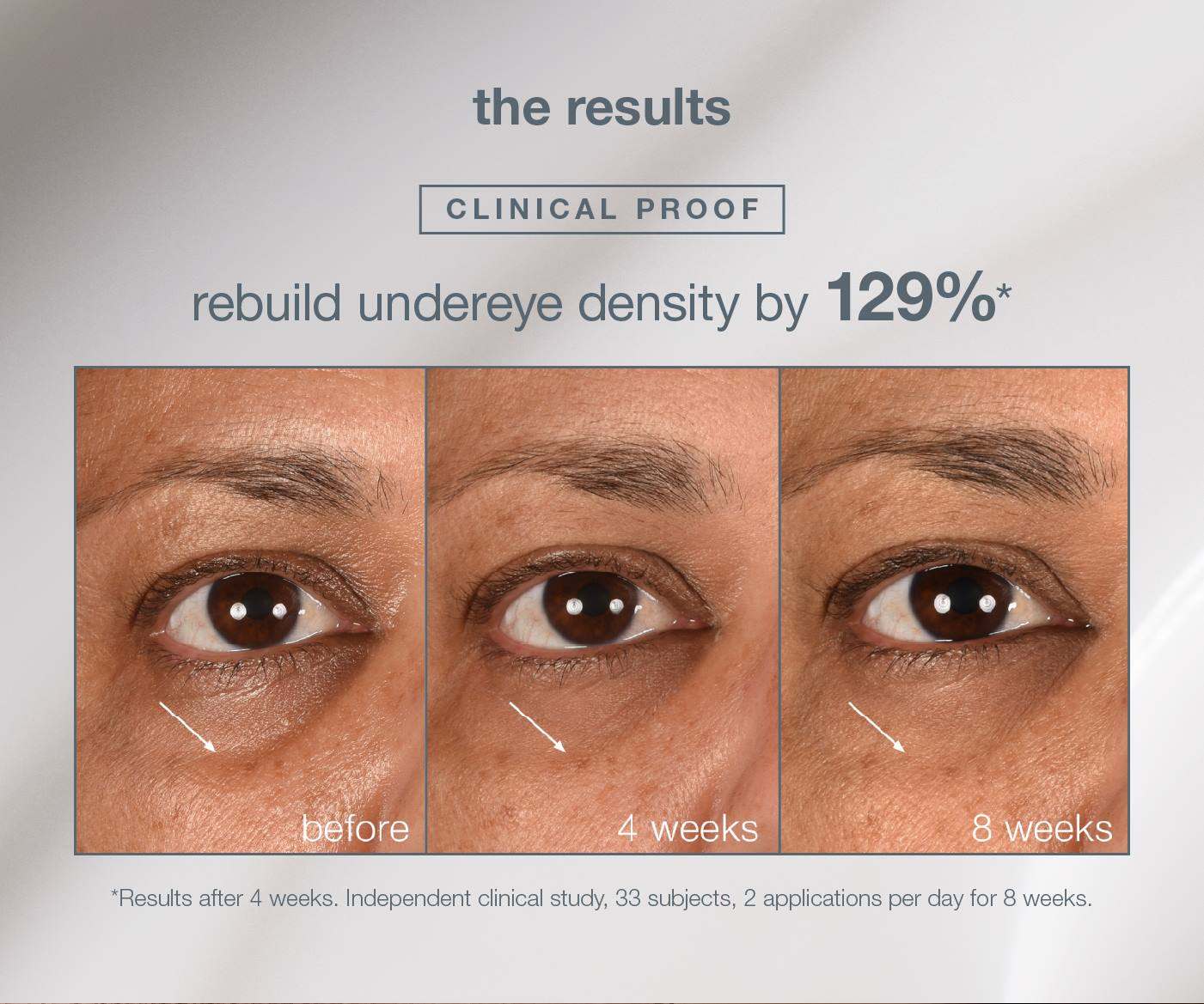  the results​  ​  CLINICAL PROOF​  rebuild undereye density by 129%*​  [B&A]​  CTA: SHOP NOW​  ​  *Results after 4 weeks. Independent clinical study, 33 subjects, 2 applications per day for 8 weeks. ​
