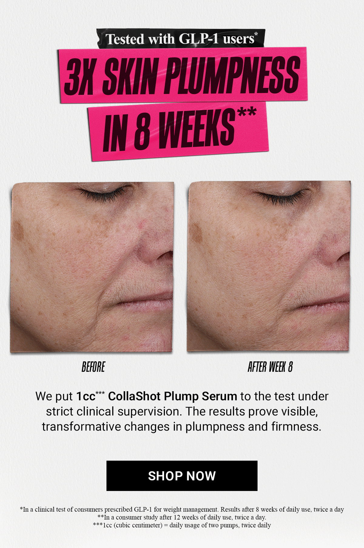 3X SKIN PLUMPNESS IN 8 WEEKS**