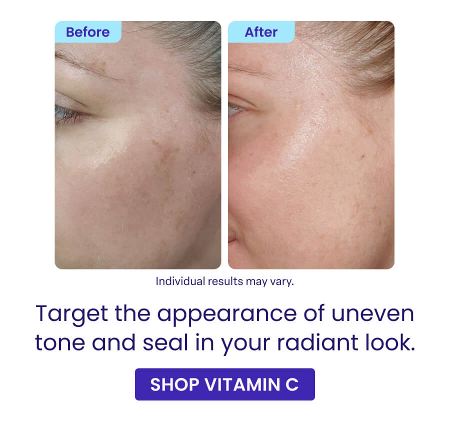 Before After Individual results may vary. Target the appearance of uneven tone and seal in your radiant look. SHOP VITAMIN C