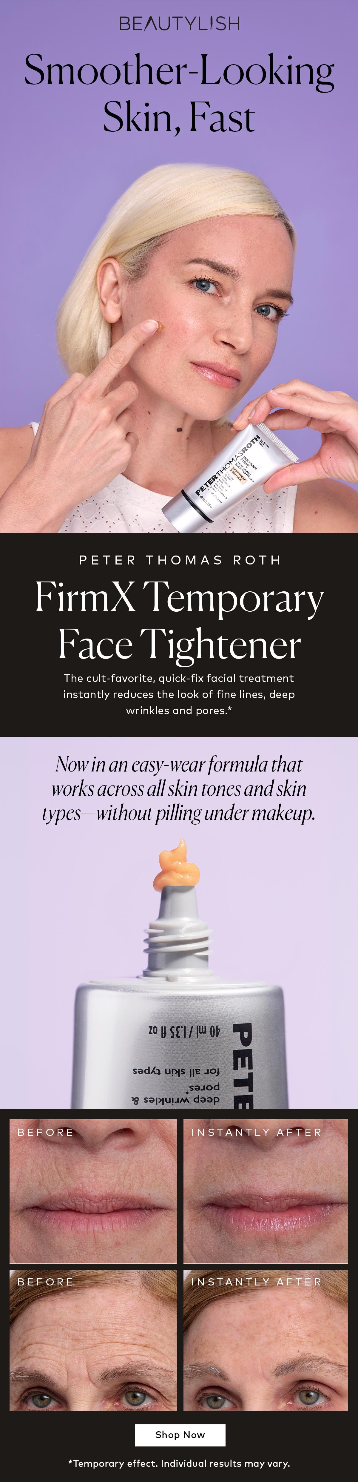 The cult-favorite, quick-fix facial treatment instantly reduces the look of fine lines, deep wrinkles and pores.* Now in an easy-wear formula that works across all skin tones and skin types—without pilling under makeup. Shop the Peter Thomas Roth FIRMx® Temporary Face Tightener Easy Wear Formula at Beautylish.com. *Temporary effect. Individual results may vary.
