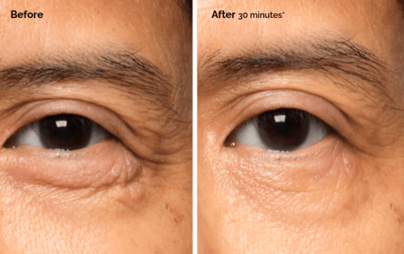 Explore the research behind Lacto-PDRN 4% + B9 Eye Cream.