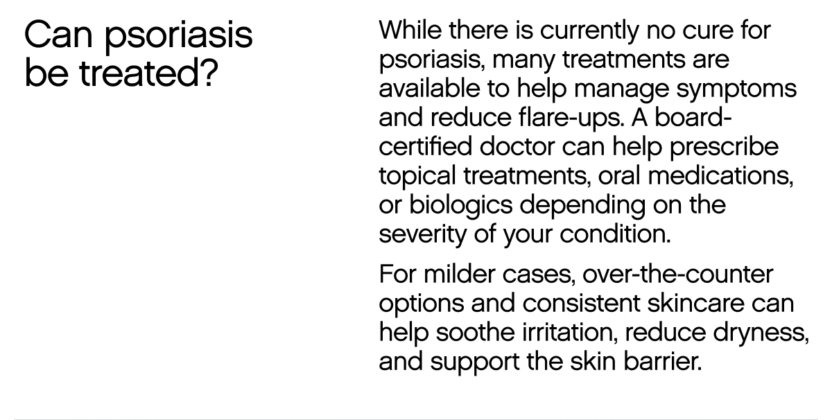 Can psoriasis be treated?