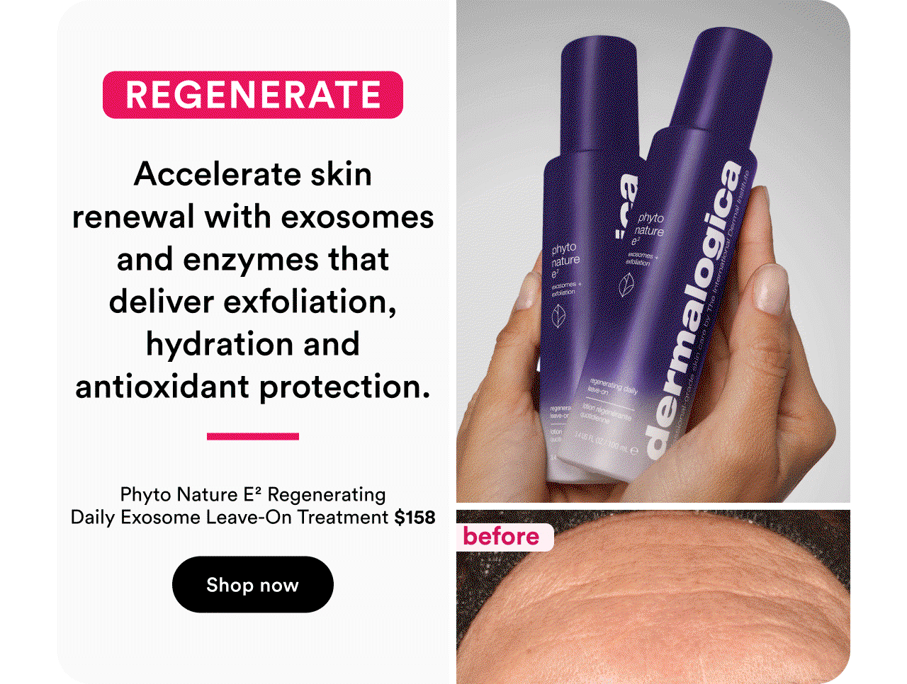 Regenerate | Phyto Nature E2 Regenerating Daily Exosome Leave-On Treatment | Shop now