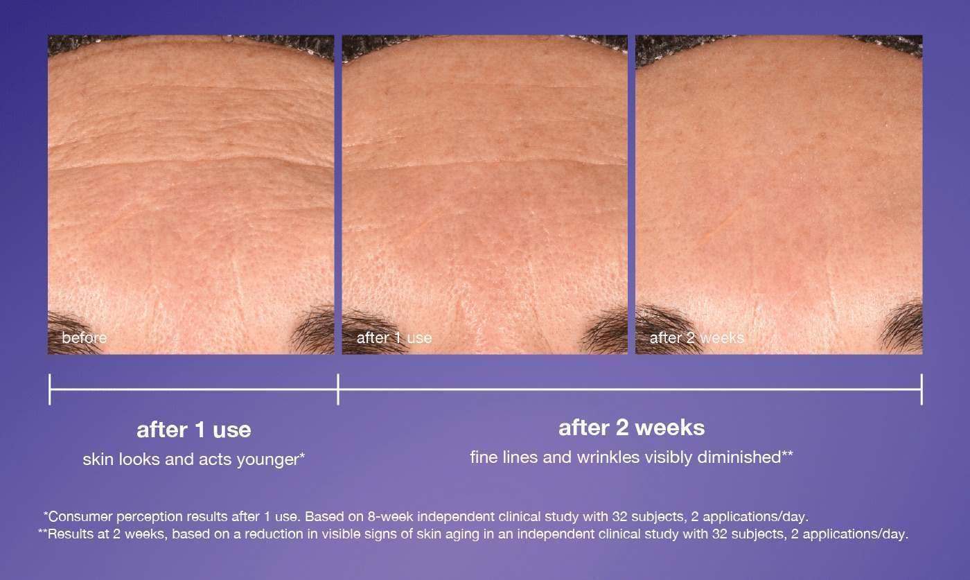 regnerating daily leave on | improves skin's natural regeneration by 86%* | before | after 2 weeks** | *versus untreated skin. based on in vitro testing. ** results on days 1 and 14 of an 8-week independent clinical study with 32 subjects, 2 applications/day.