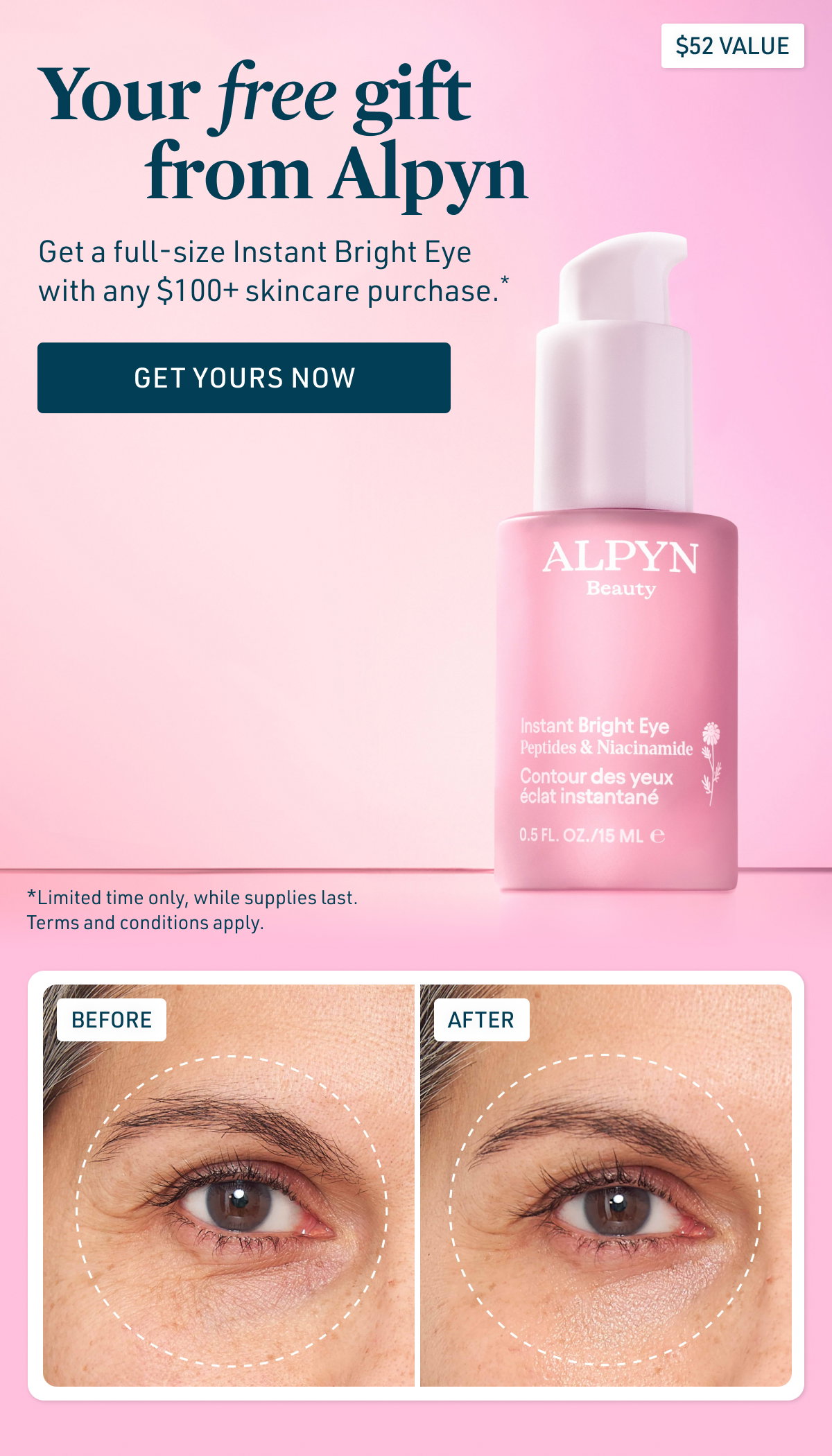 Your free gift from Alpyn