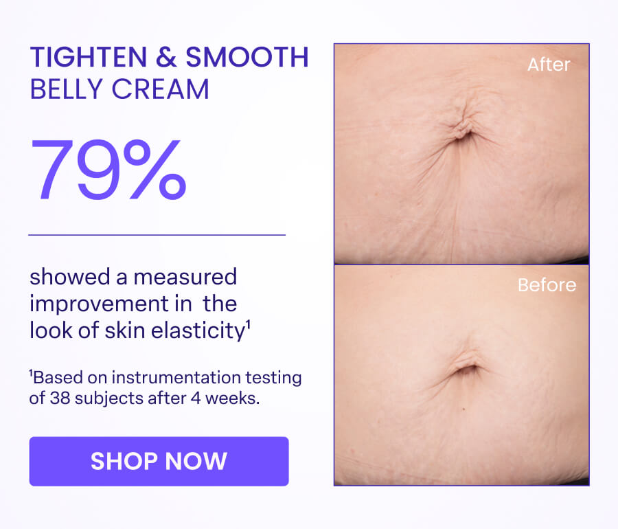 TIGHTEN & SMOOTH BELLY CREAM After 79% showed a measured improvement in the look of skin elasticity¹ Before 'Based on instrumentation testing of 38 subjects after 4 weeks. SHOP NOW