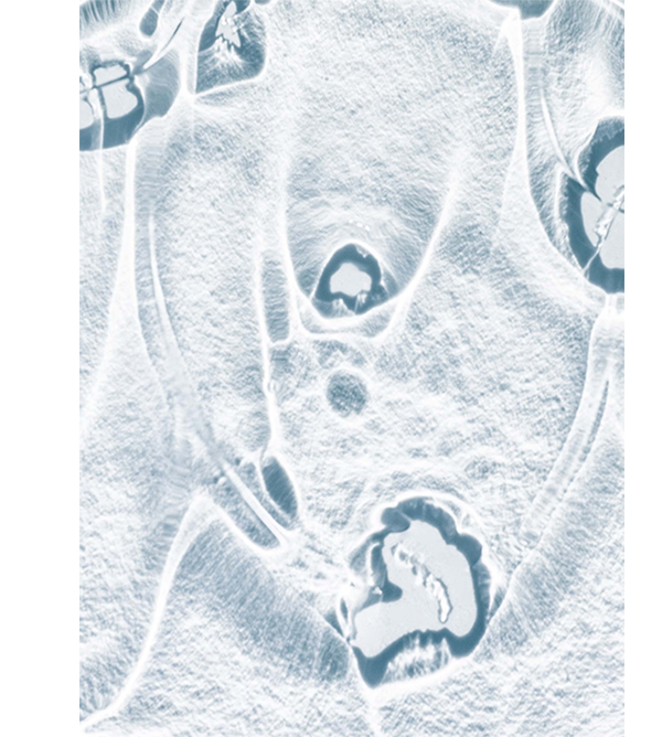 Microscopic cellular structure showing moisture barrier repair
