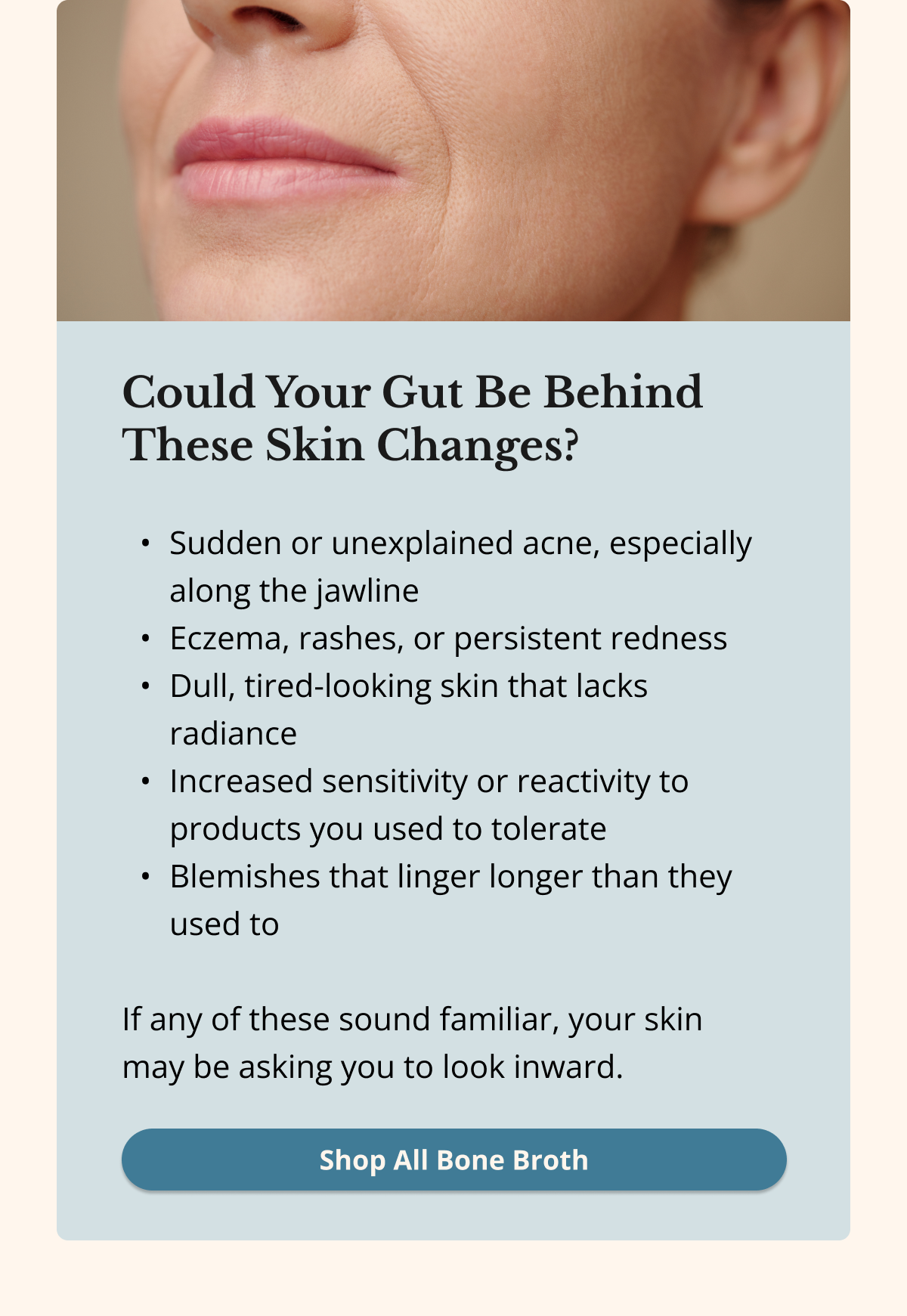 Could Your Gut Be Behind These Skin Changes? Sudden or unexplained acne, especially along the jawline Eczema, rashes, or persistent redness Dull, tired-looking skin that lacks radiance Increased sensitivity or reactivity to products you used to tolerate Blemishes that linger longer than they used to  If any of these sound familiar, your skin may be asking you to look inward. Shop All Bone Broth