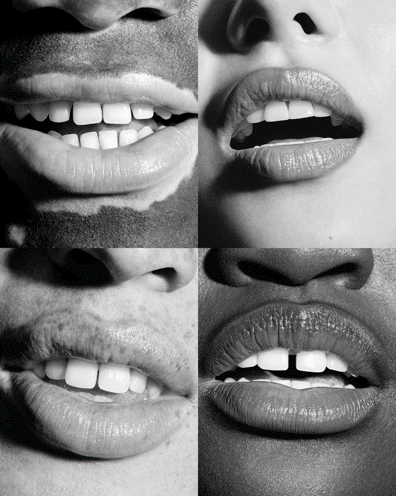 Four images of mouths showing healthy teeth