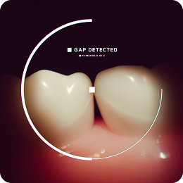 Representation of the Dyson CameraJet toothbrush detecting gaps between teeth.