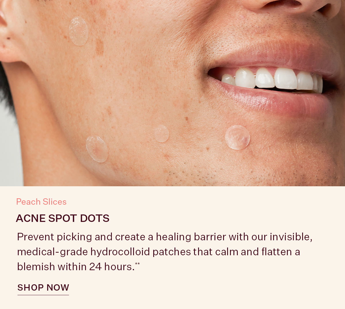 Acne Spot Dots