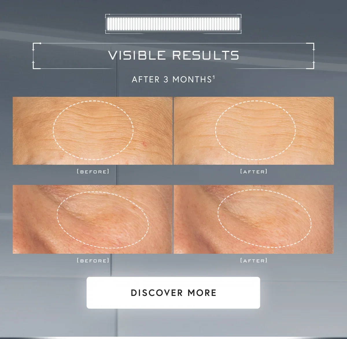 VISIBLE RESULTS 