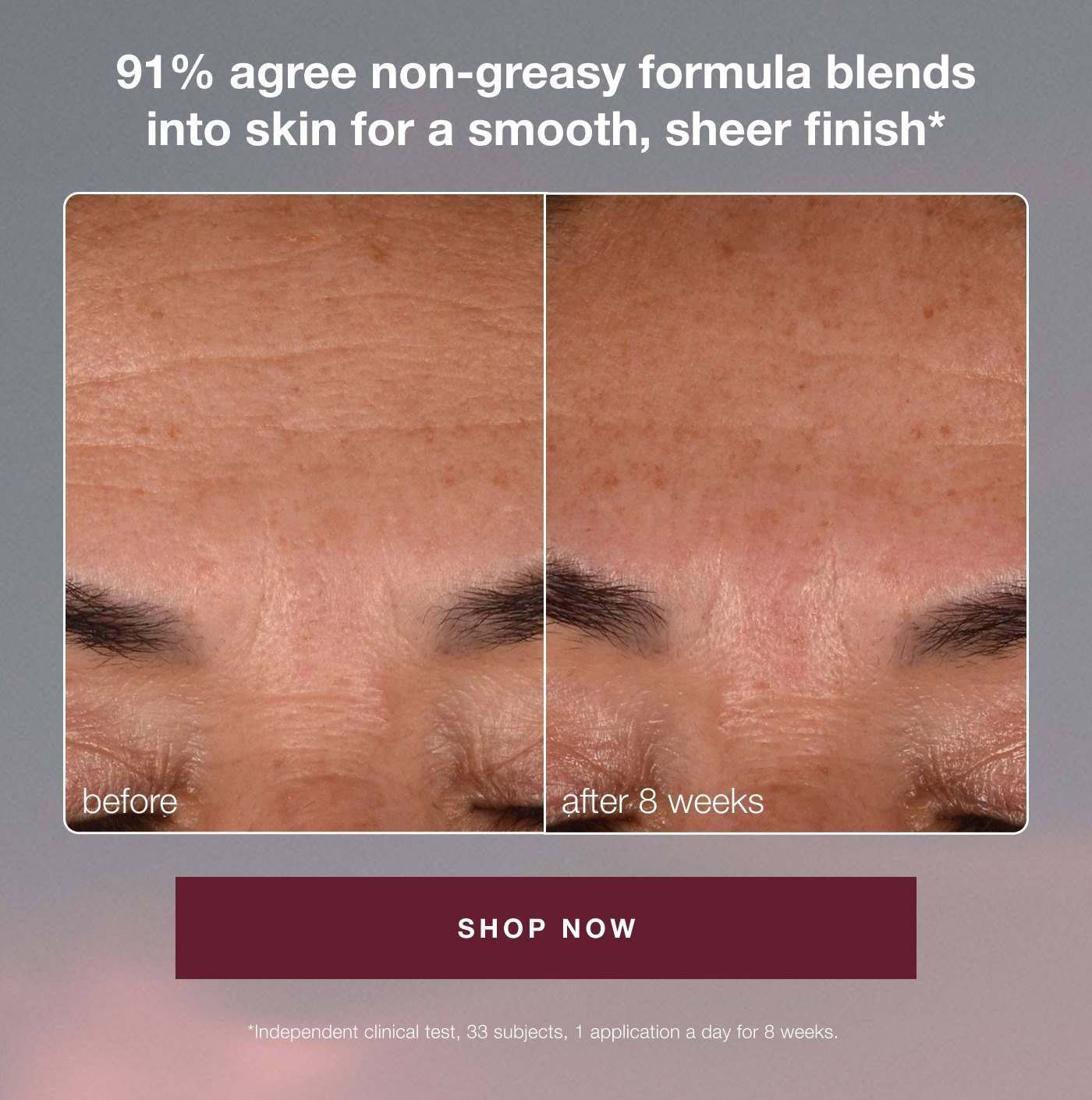 91% agree non-greasy formula blends into skin for a smooth, sheer finish* | before | after 8 weeks | SHOP NOW | *independent clinical test, 33 subjects 1 applications a day for 8 weeks