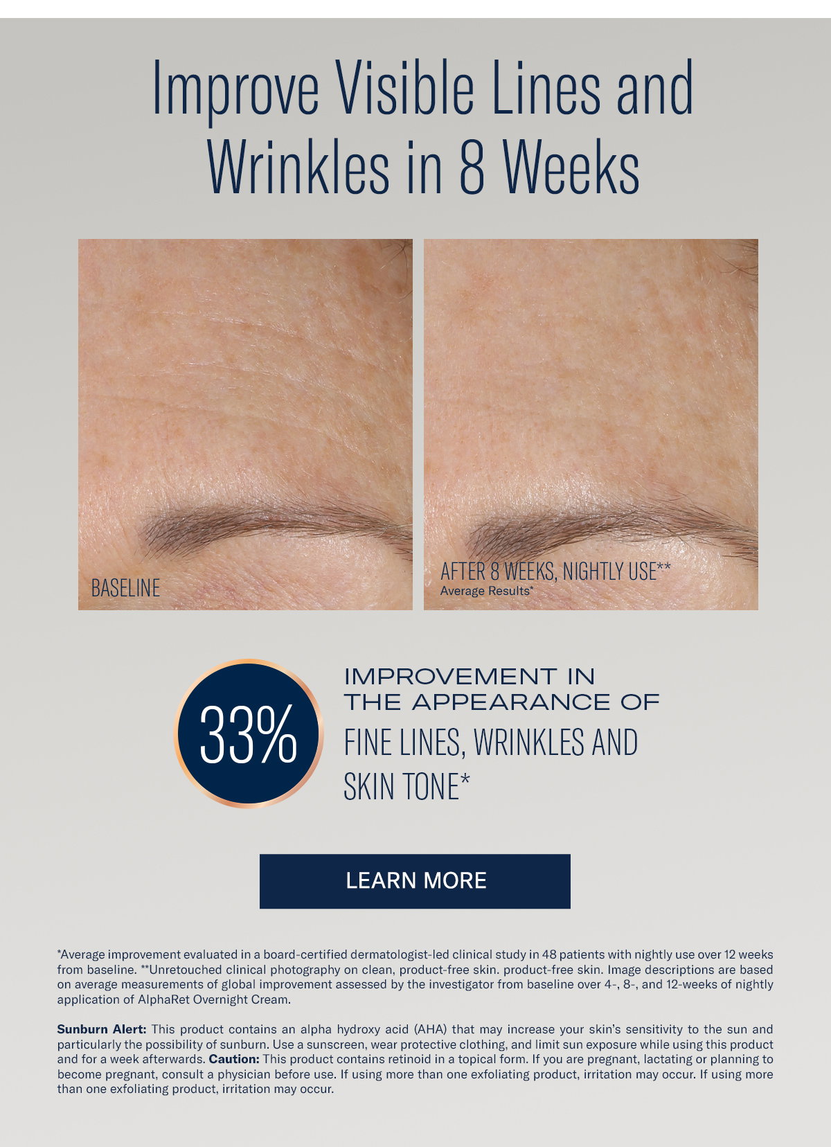 improve visible lines