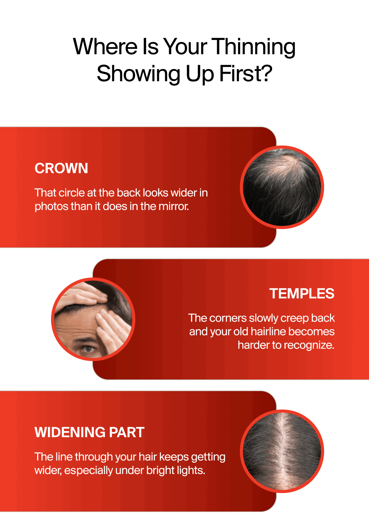 WHERE IS YOUR THINNING SHOWING UP FIRST?