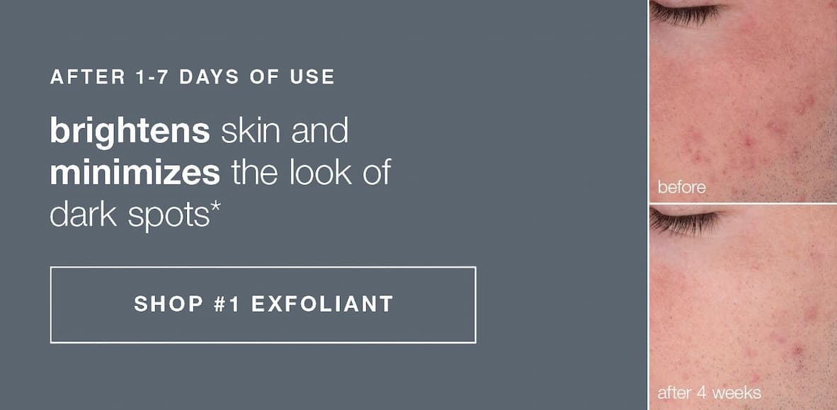 after 1-7 days of use Brightens skin and minimizes the look of dark spots | SHOP #1 EXFOLIANT