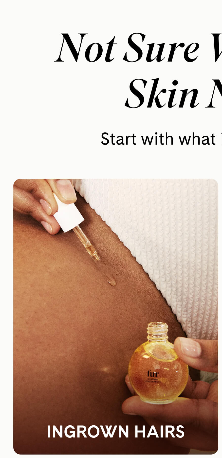 Ingrown Hairs