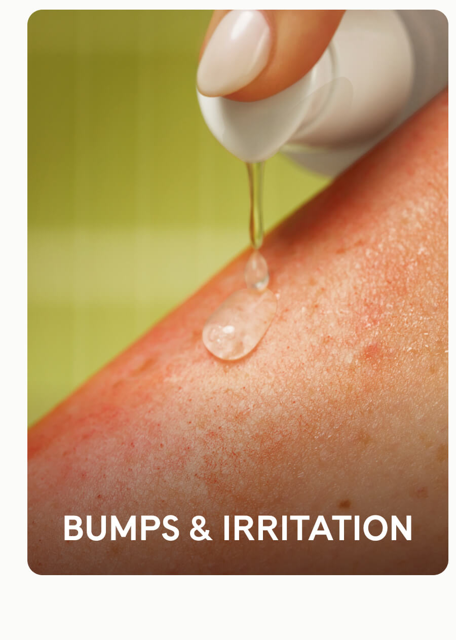 Bumps & Irriation