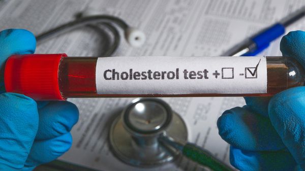 Votre mauvais cholestérol est-il trop élevé? Les seuils à respecter selon votre profil