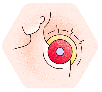 Symbol für Schmerzen im Kopf- und Nackenbereich.