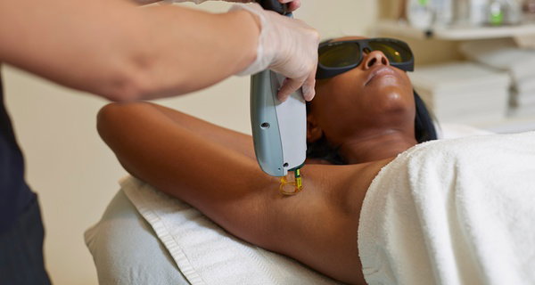 Épilation au laser pour une peau soyeuse et durablement douce