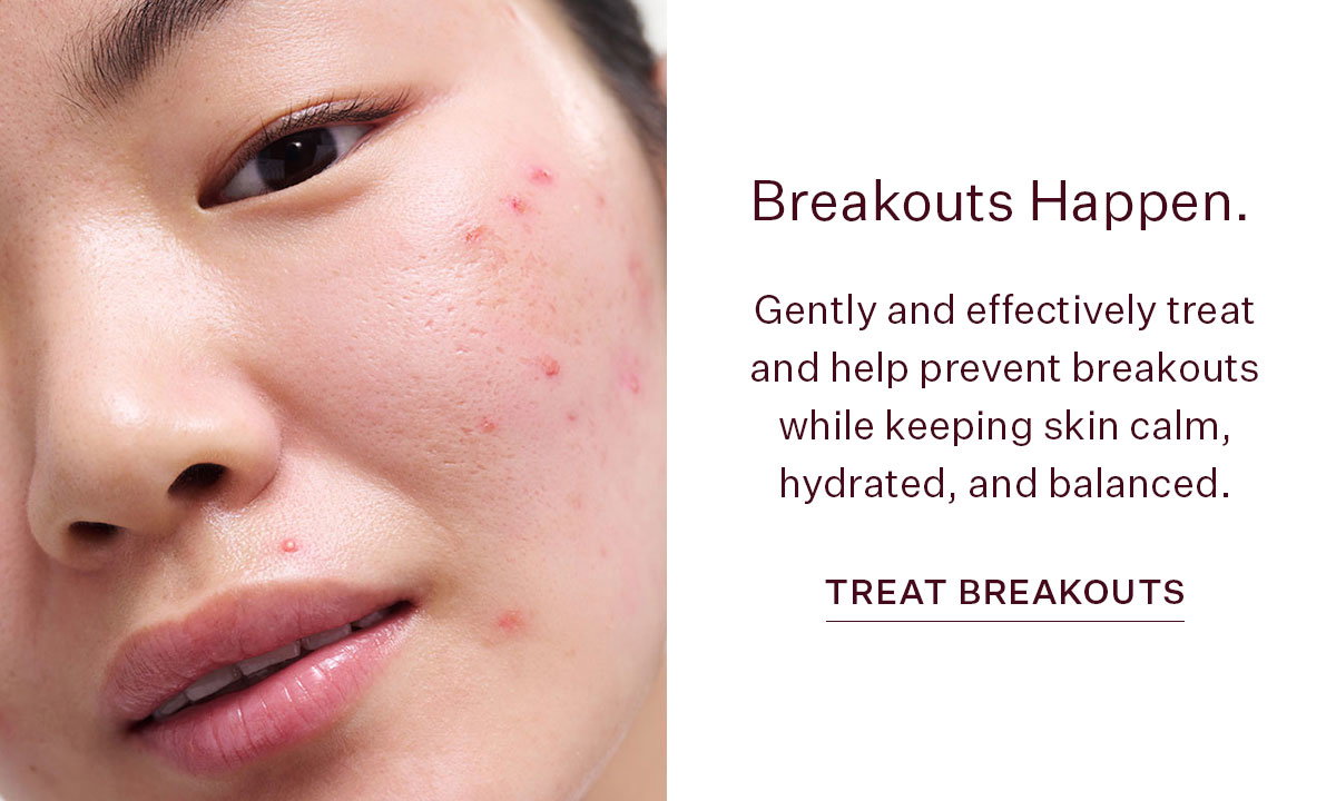 Breakouts happen.