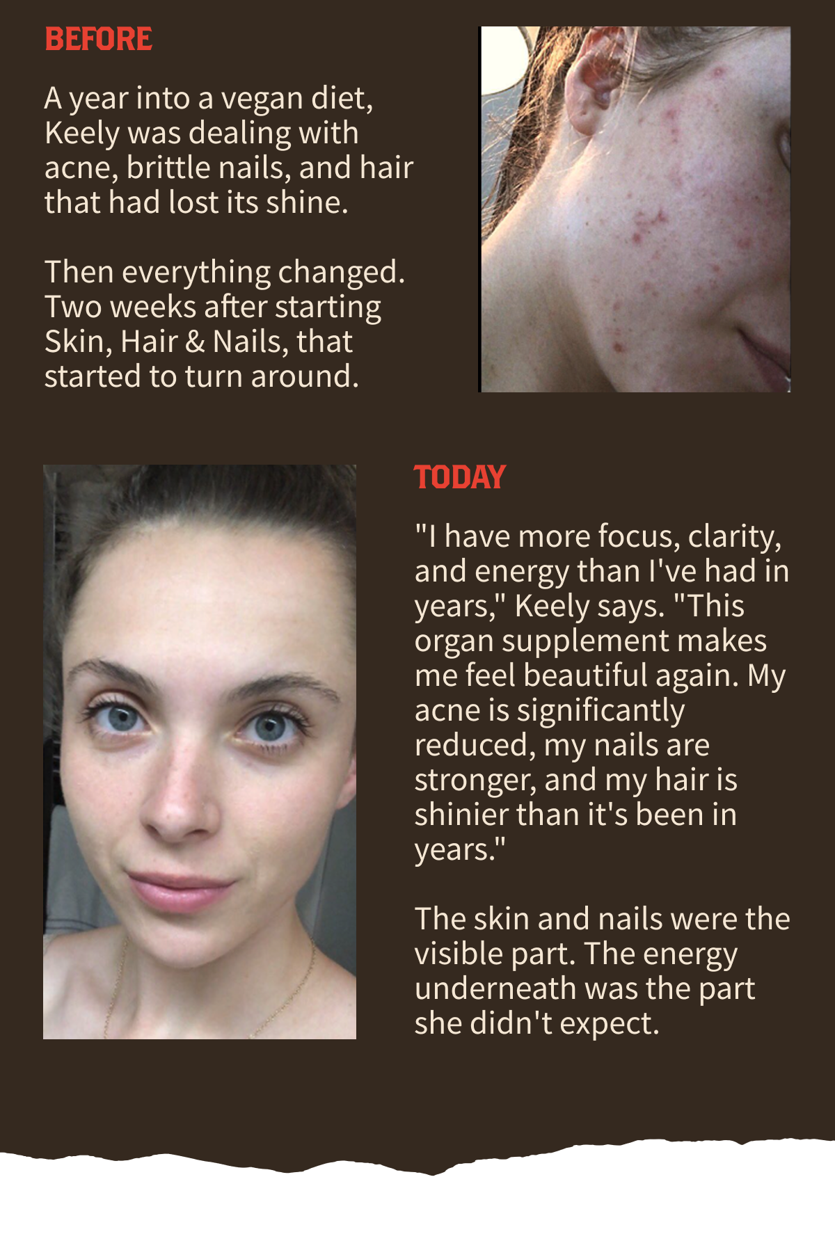 Kelly's transformation 