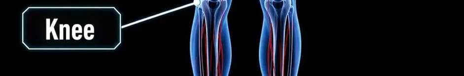 DonJoyStore_Knee