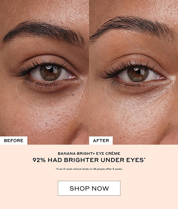 92% HAD BRIGHTER UNDEREYES. 