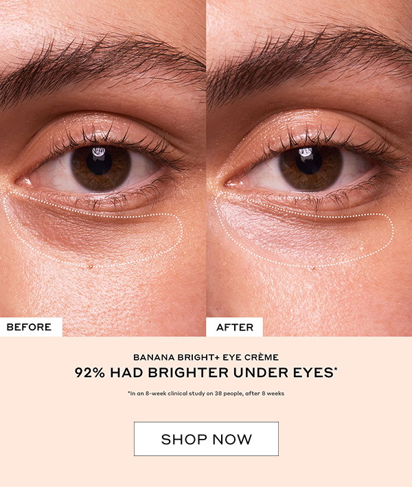 92% HAD BRIGHTER UNDEREYES. 