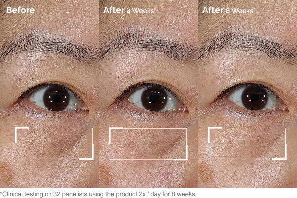Shop our Lacto-PDRN* 4% + B9 Eye Cream.
