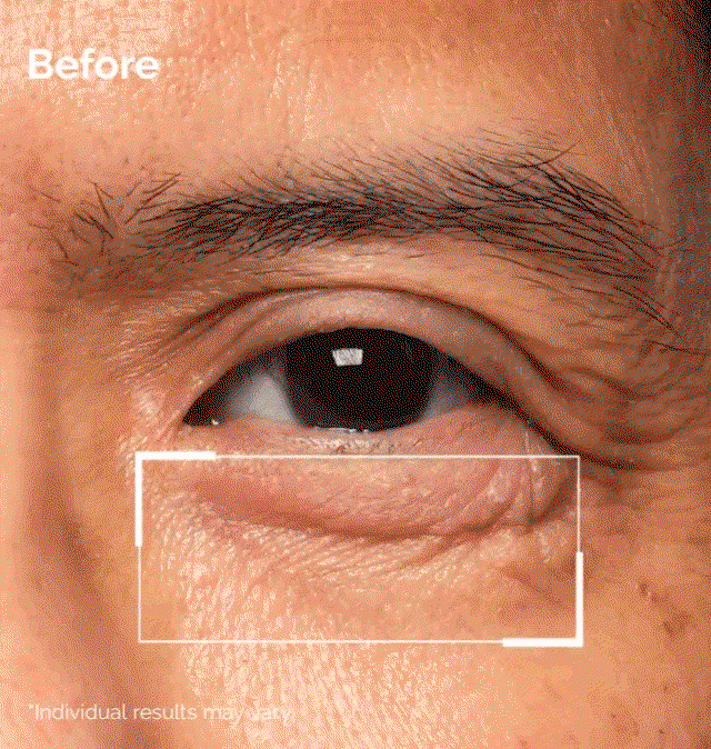 Shop our Lacto-PDRN* 4% + B9 Eye Cream.