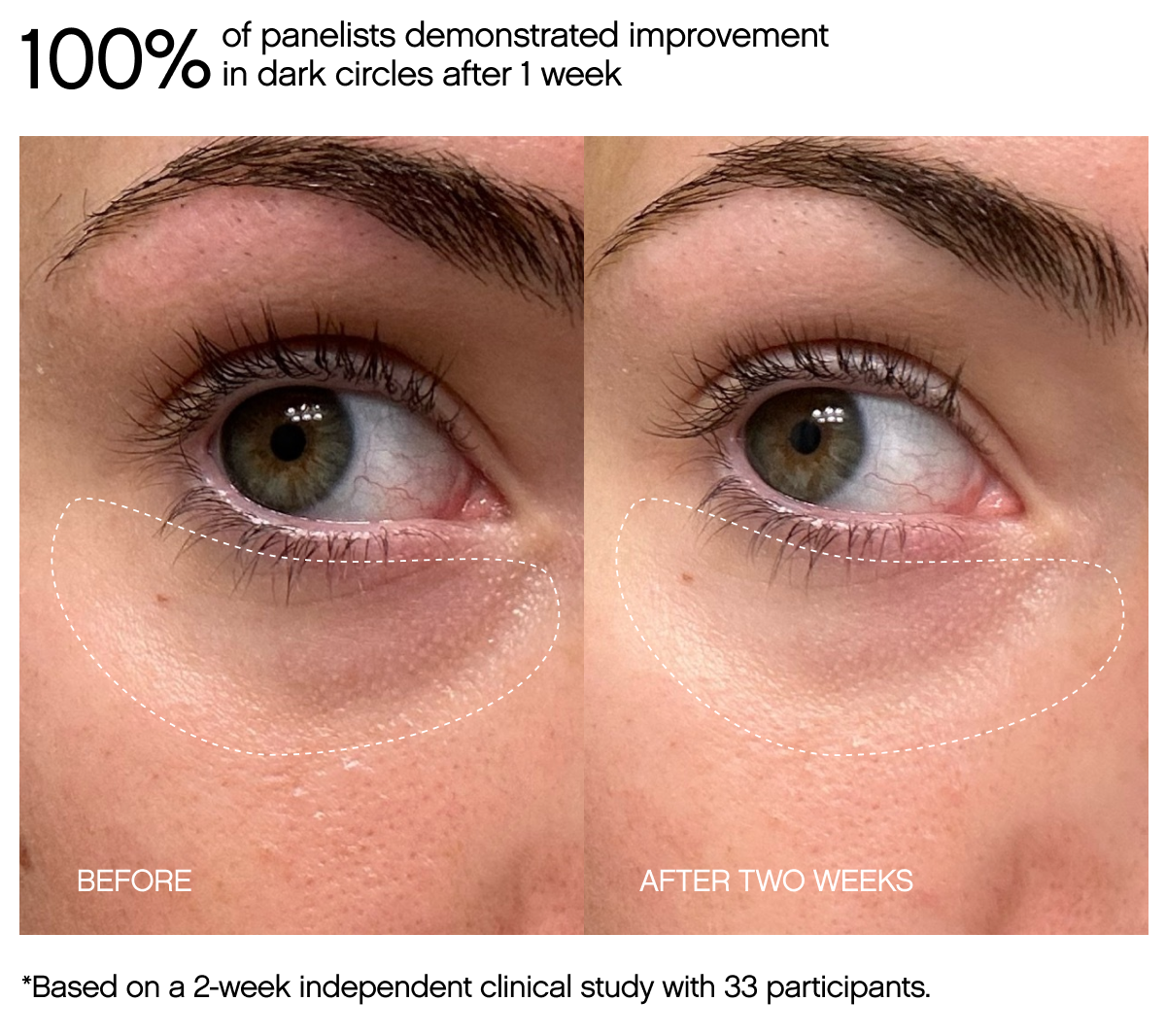 100% of panelists demonstrated improvement in dark circles after 1 week