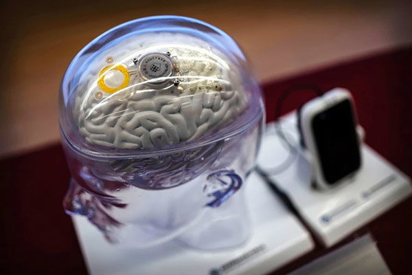 A brain–computer interface system is shown on a model of a brain through a transparent skull.