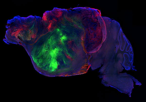 Side view of a xenocortical mouse brain showing nerve fibres extending from the human graft through the mouse brain, resembling a tissue sample with a fluorescent section.