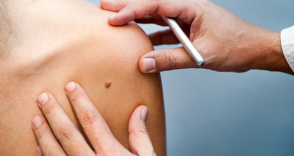 Advanced Skin Imperfection Removal with One to Ten Treatments!