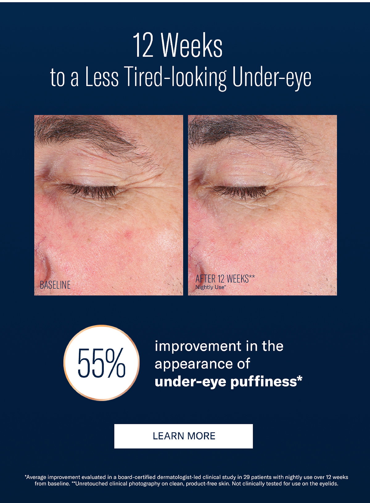 hydrating skin