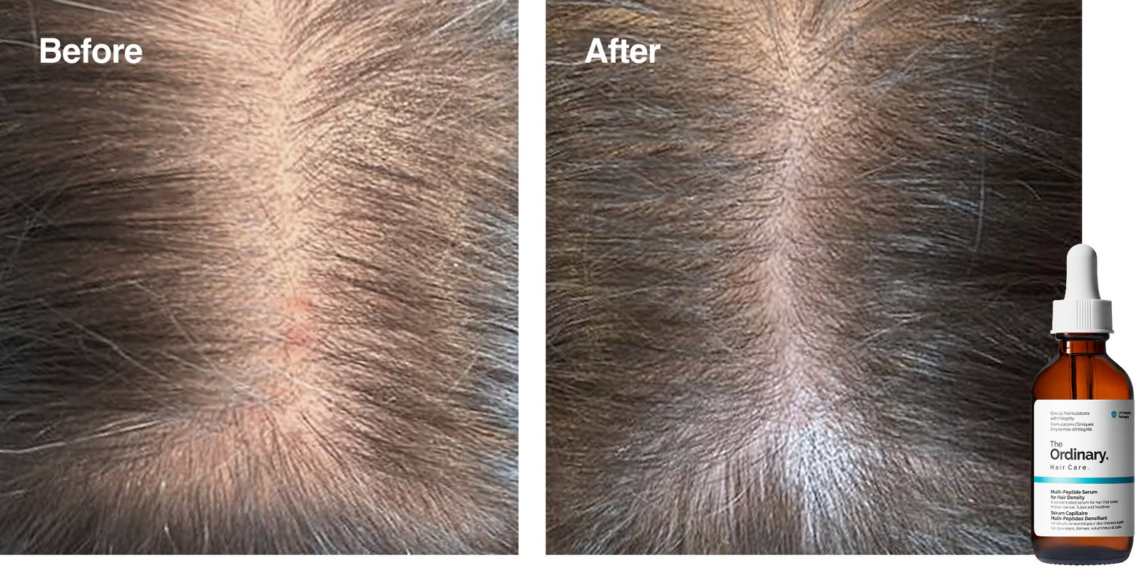 Shop Multi-Peptide Serum for Hair Density