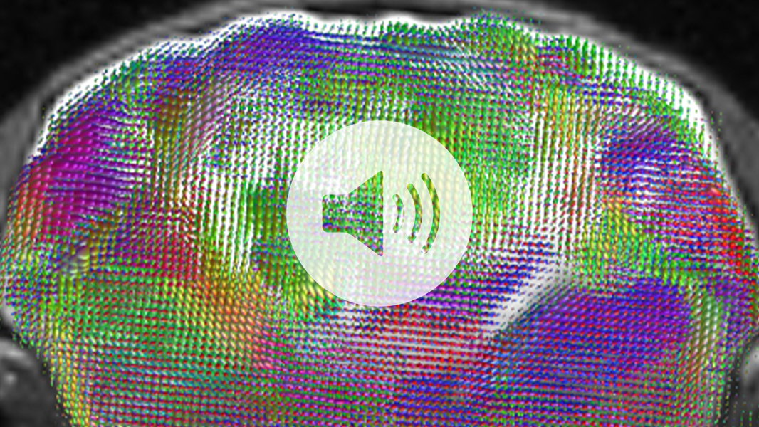 Click to listen