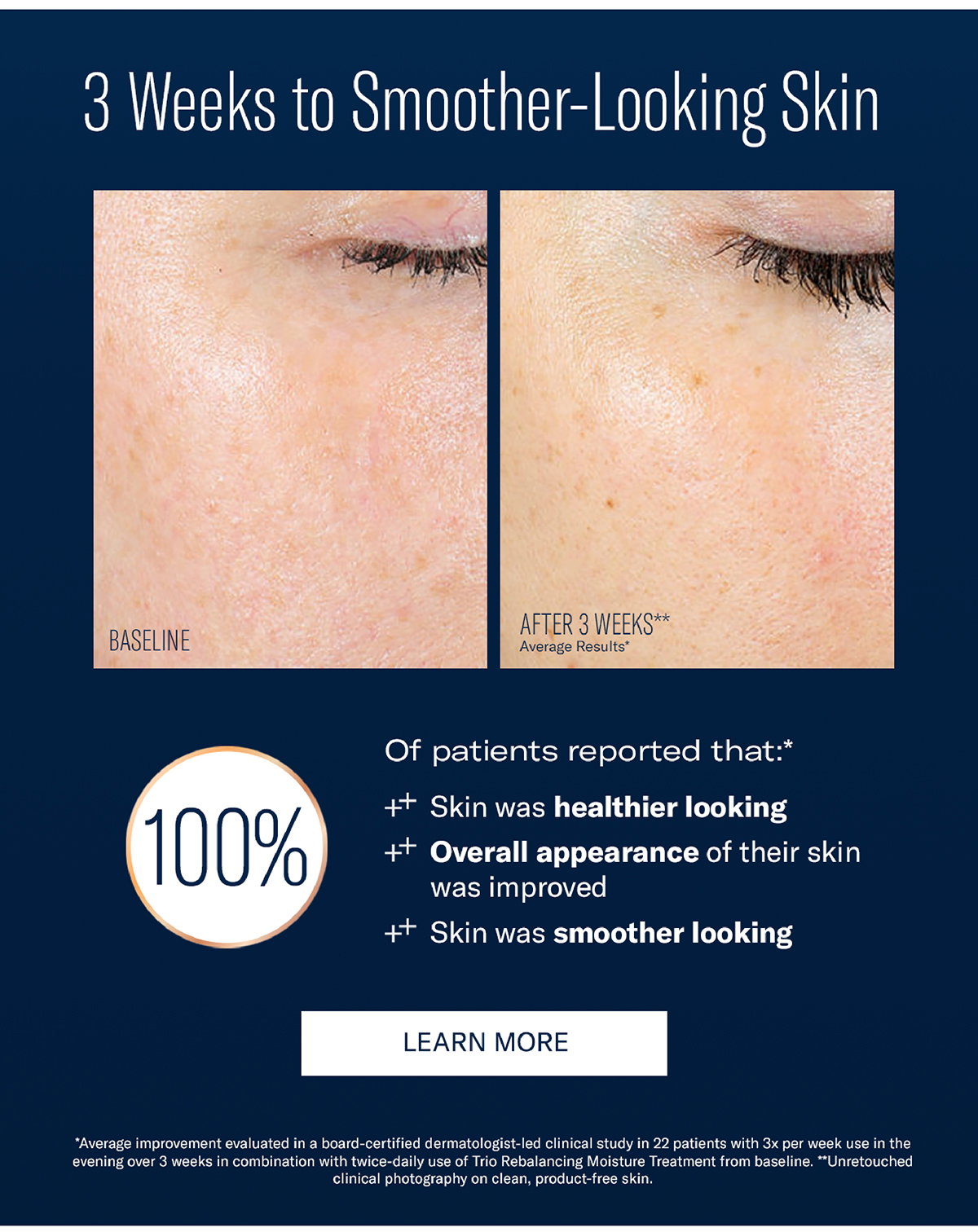 smoother-looking skin