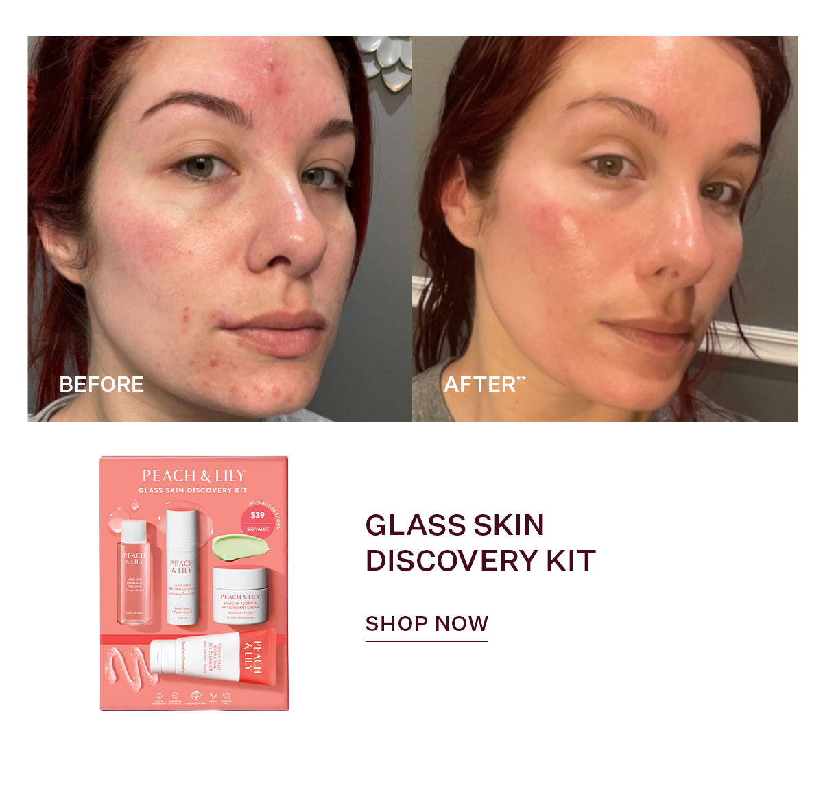 Glass Skin Discovery Kit