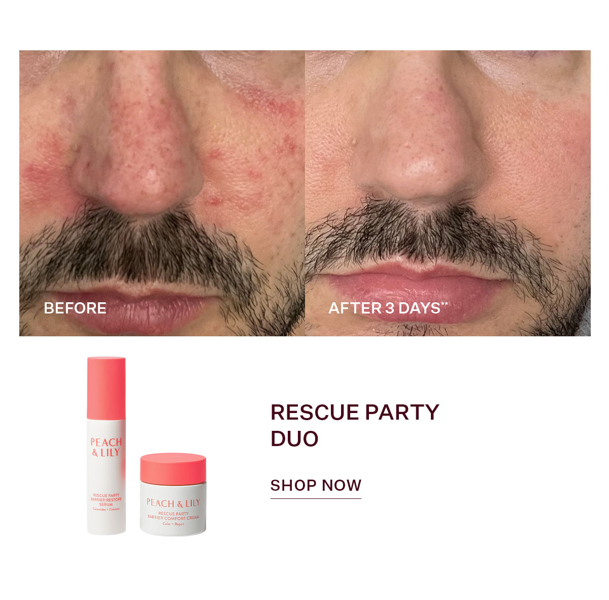 Rescue Party Duo