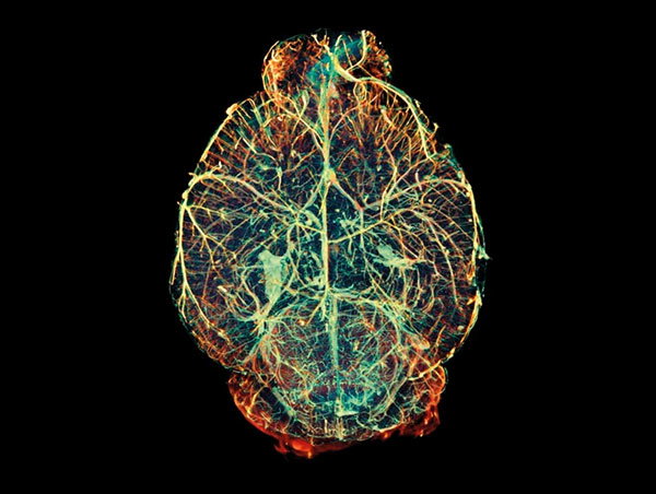 An optical projection tomography image of a mouse brain showing an intricate network of blood vessels.