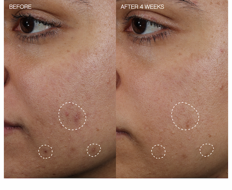 B+A